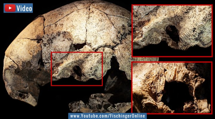 Video: Die Steinzeit-Klinik: Medizinische Operationen vor 5500 Jahren - von ausgebildeten Medizinern! (Bilder: S. Díaz-Navarro/ Nature)